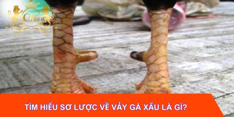 Tìm hiểu sơ lược về vảy gà xấu là gì?