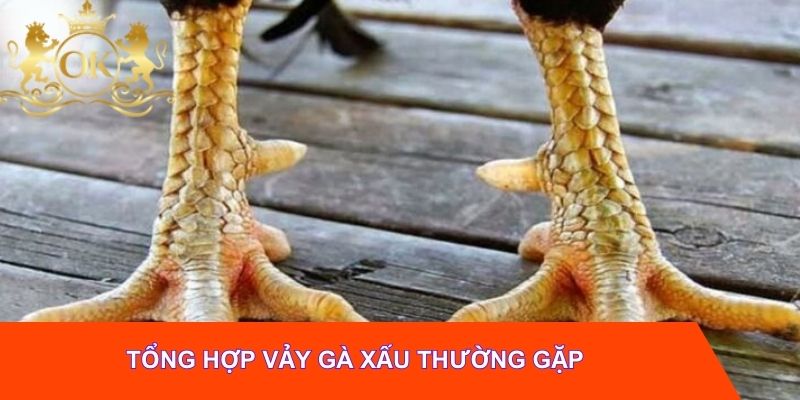 Tổng hợp vảy gà xấu thường gặp